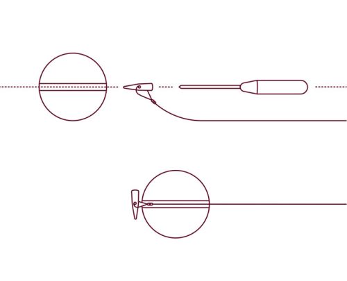 Delphin Q-STOP / yellow+pink 7mm